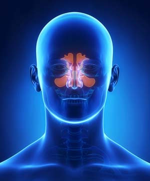 Sinusitis is treated by the doctors at Redding Allergy and Asthma Specialists
